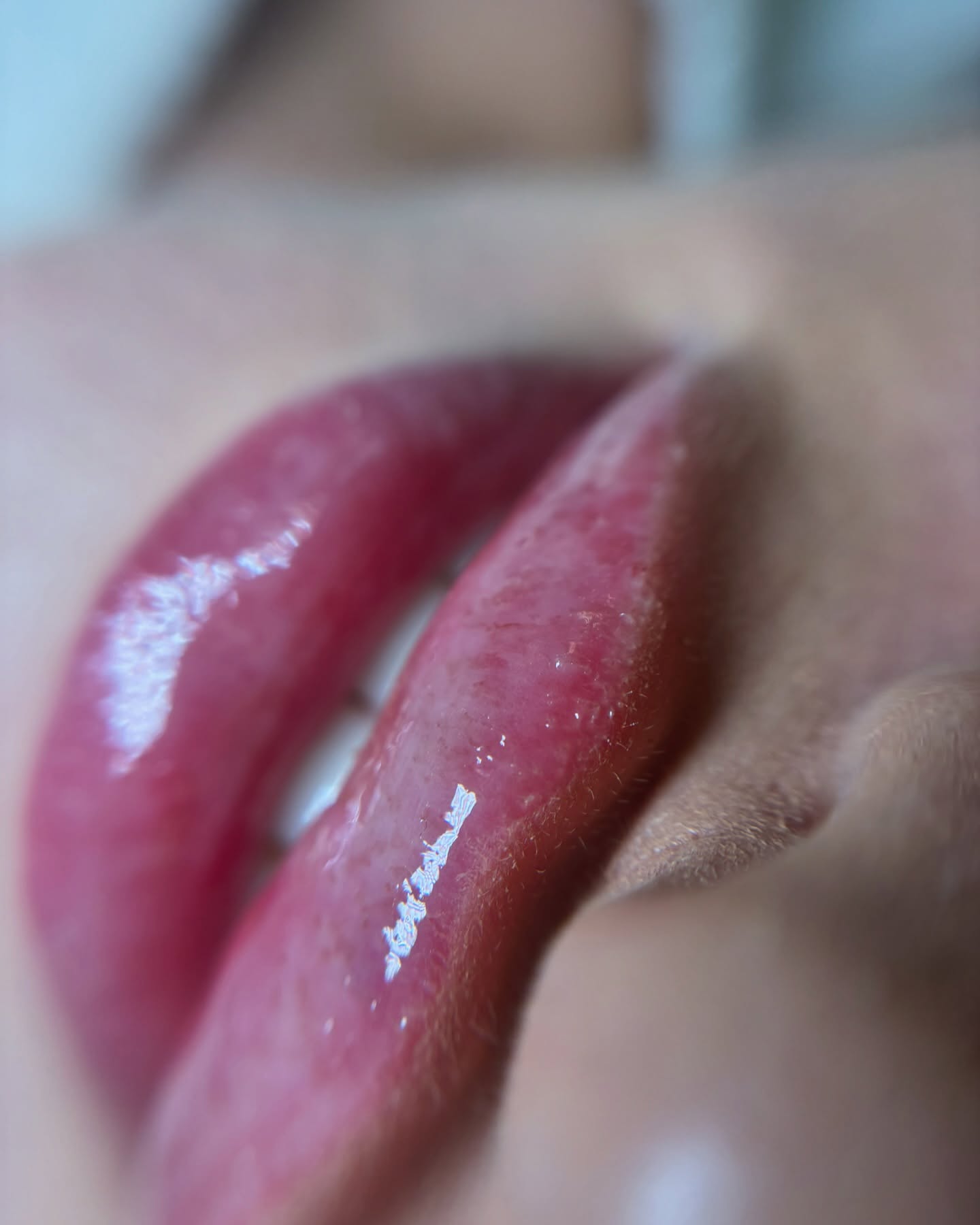 Powiększanie ust – piękny efekt